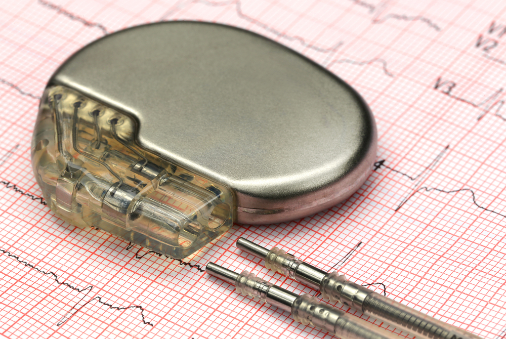 flex-rigid PCBs for pacemakers